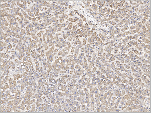 product-image-AAA27774_IHC3.png