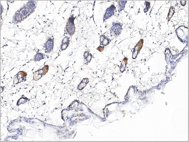 product-image-AAA27774_IHC4.png