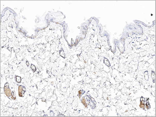 product-image-AAA27774_IHC5.png