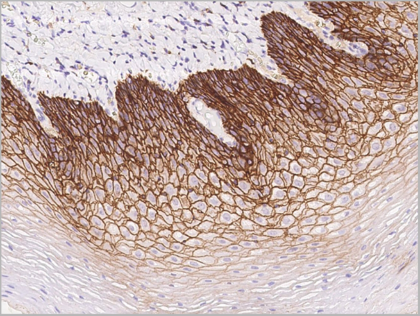 product-image-AAA27780_IHC2.png