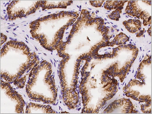 product-image-AAA27780_IHC4.png