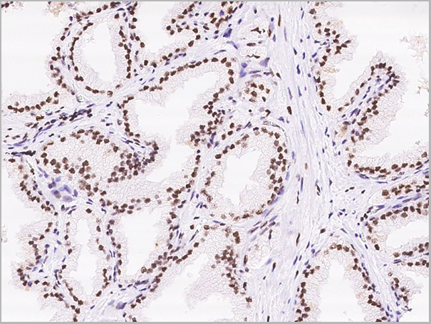 product-image-AAA27781_IHC2.png
