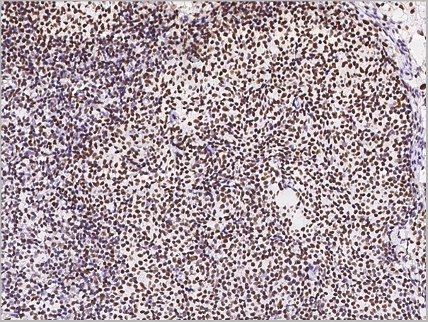 product-image-AAA27781_IHC4.png