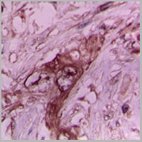 product-image-AAA27787_IHC2.jpg