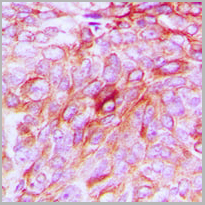 product-image-AAA27793_IHC2.jpg