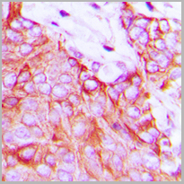 product-image-AAA27798_IHC2.jpg