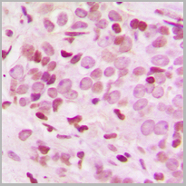 product-image-AAA27801_IHC2.jpg