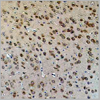 product-image-AAA27803_IHC2.jpg