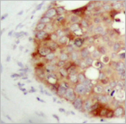 product-image-AAA27804_IHC2.jpg