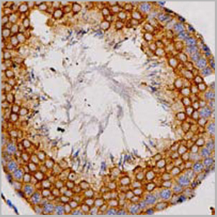 product-image-AAA27805_IHC2.jpg