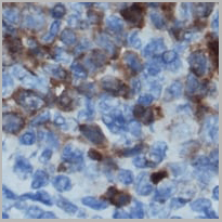 product-image-AAA27806_IHC2.jpg