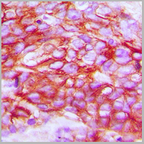 product-image-AAA27809_IHC2.jpg