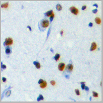 product-image-AAA27811_IHC2.jpg
