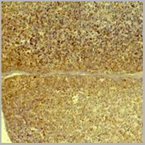 product-image-AAA27814_IHC2.jpg