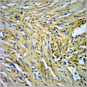 product-image-AAA27816_IHC3.png