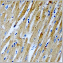 product-image-AAA27856_IHC2.jpg