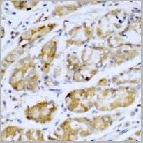 product-image-AAA27858_IHC2.jpg