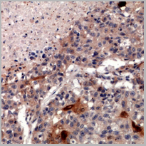 product-image-AAA27865_IHC2.jpg