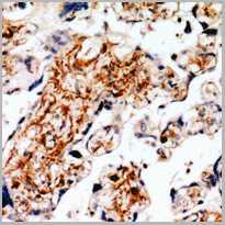 product-image-AAA27866_IHC2.jpg