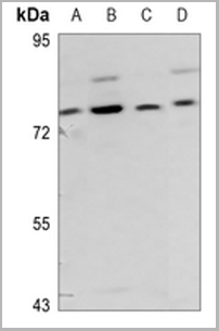 product-image-AAA27866_WB.png