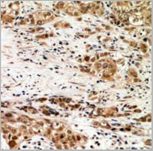 product-image-AAA27885_IHC2.jpg