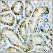 product-image-AAA27895_IHC3.png