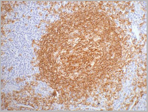 product-image-AAA27908_IHC.jpg