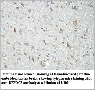 product-image-AAA27913_IHC2.jpg