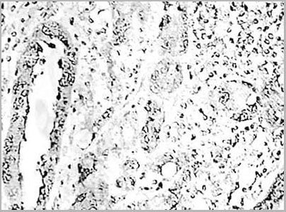 product-image-AAA27926_IHC3.jpg