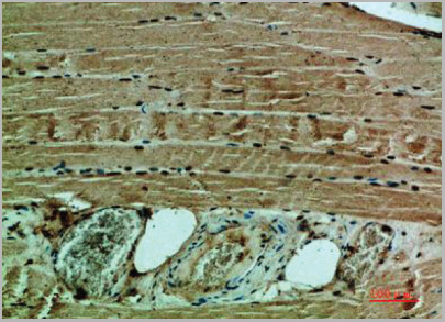 product-image-AAA27944_IHC.jpg