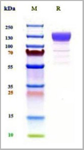 product-image-AAA27945_SDS_PAGE.jpg