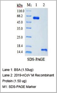 product-image-AAA27951_SDS_PAGE.jpg