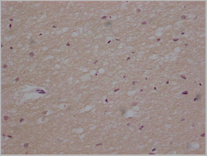 product-image-AAA28058_IHC9.jpg