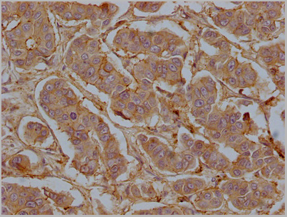 product-image-AAA28063_IHC5.jpg