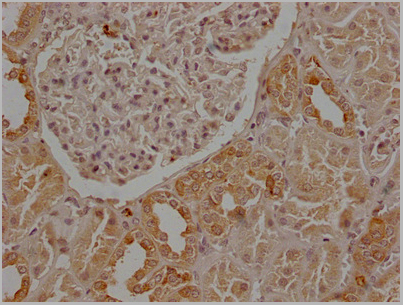 product-image-AAA28063_IHC6.jpg