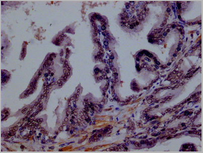 product-image-AAA28070_IHC2.jpg