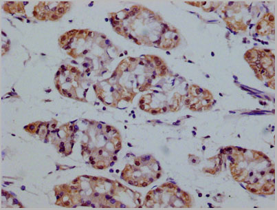 product-image-AAA28070_IHC3.jpg