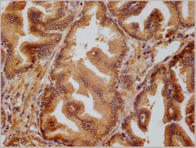 product-image-AAA28071_IHC2.jpg