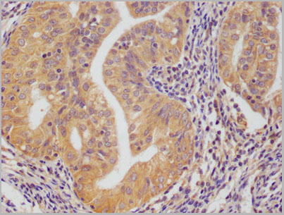 product-image-AAA28071_IHC3.jpg