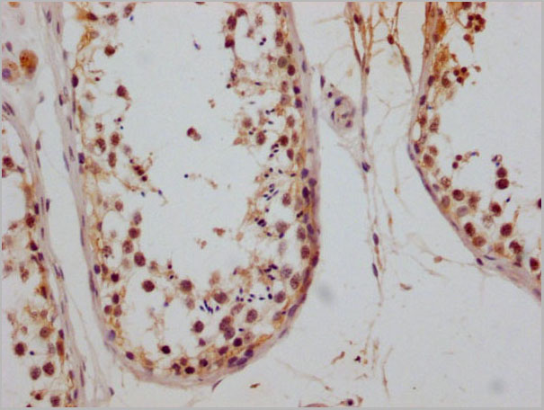 product-image-AAA28073_IHC3.jpg