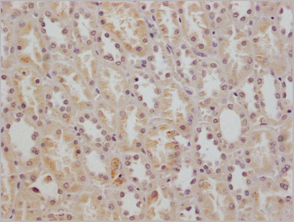 product-image-AAA28073_IHC4.jpg