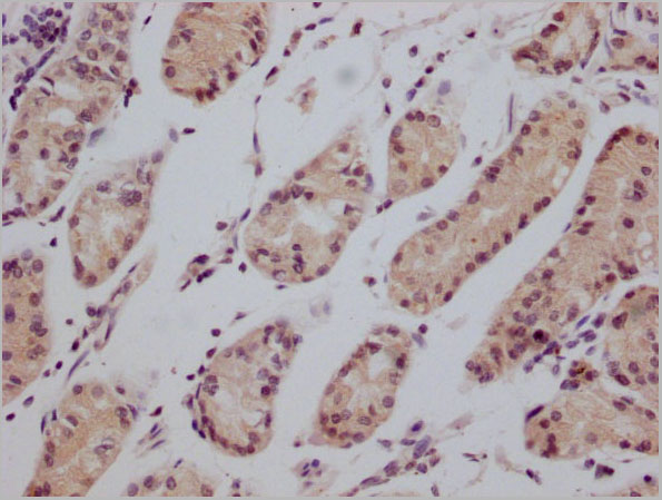 product-image-AAA28073_IHC6.jpg