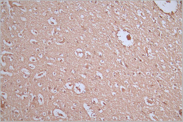 product-image-AAA28074_IHC2.jpg