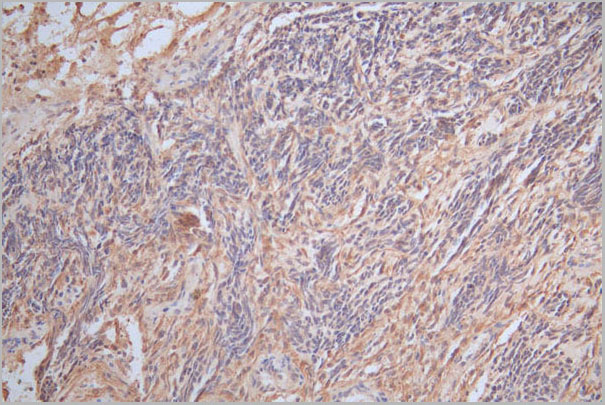 product-image-AAA28074_IHC3.jpg