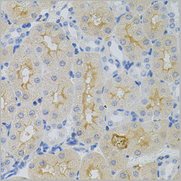 product-image-AAA28087_IHC2.jpg