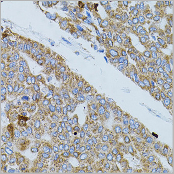 product-image-AAA28087_IHC3.jpg