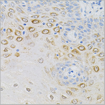product-image-AAA28087_IHC4.jpg