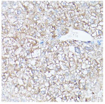 product-image-AAA28095_IHC10.jpg