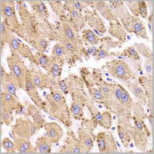 product-image-AAA28095_IHC2.jpg