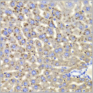 product-image-AAA28095_IHC3.jpg